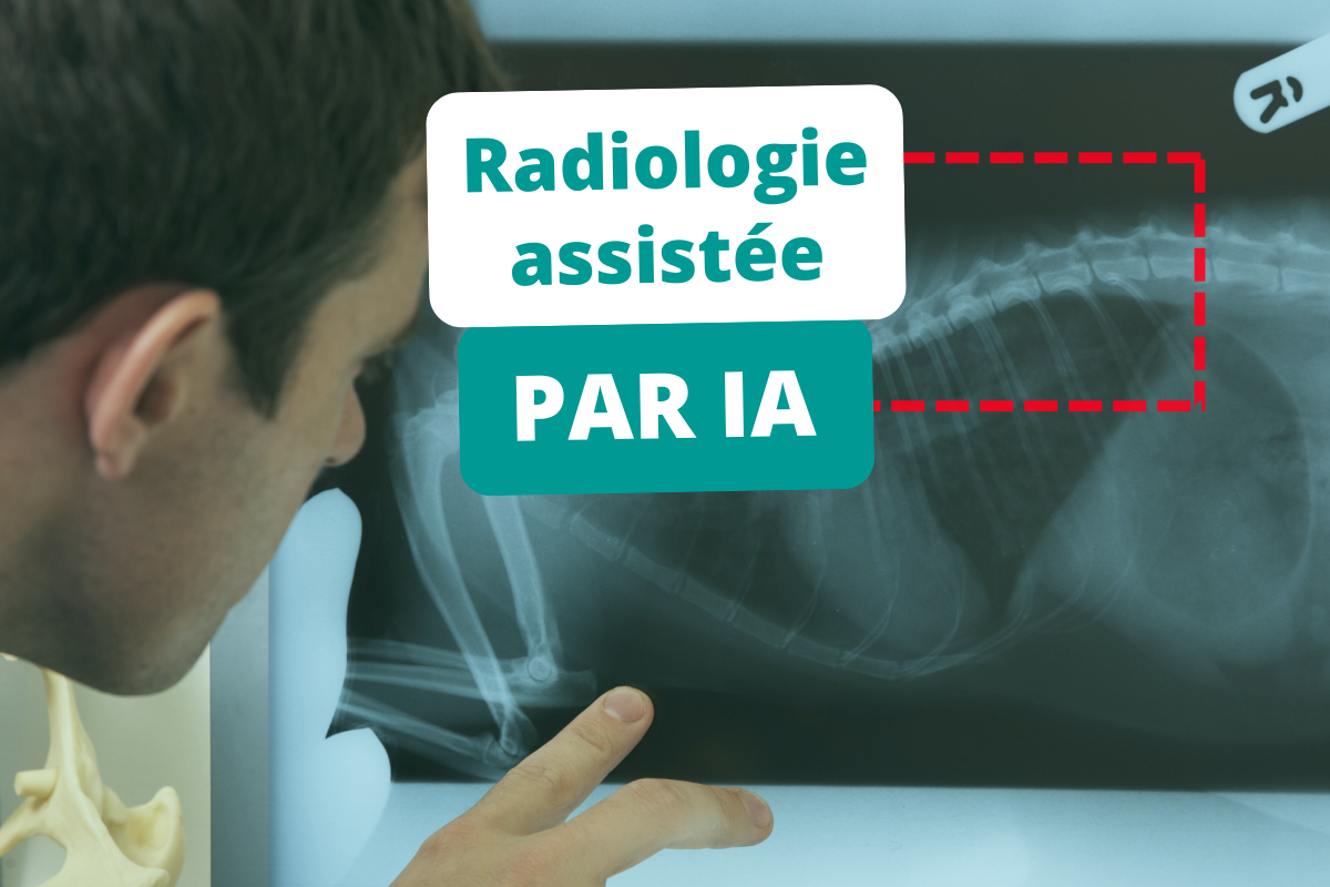 Un autre regard avec la radiologie assistée par IA